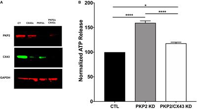 Blockade of the Adenosine 2A Receptor Mitigates the Cardiomyopathy Induced by Loss of Plakophilin-2 Expression